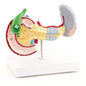 Model Of Diseased Pancreas   Spleen And Gallbladder
