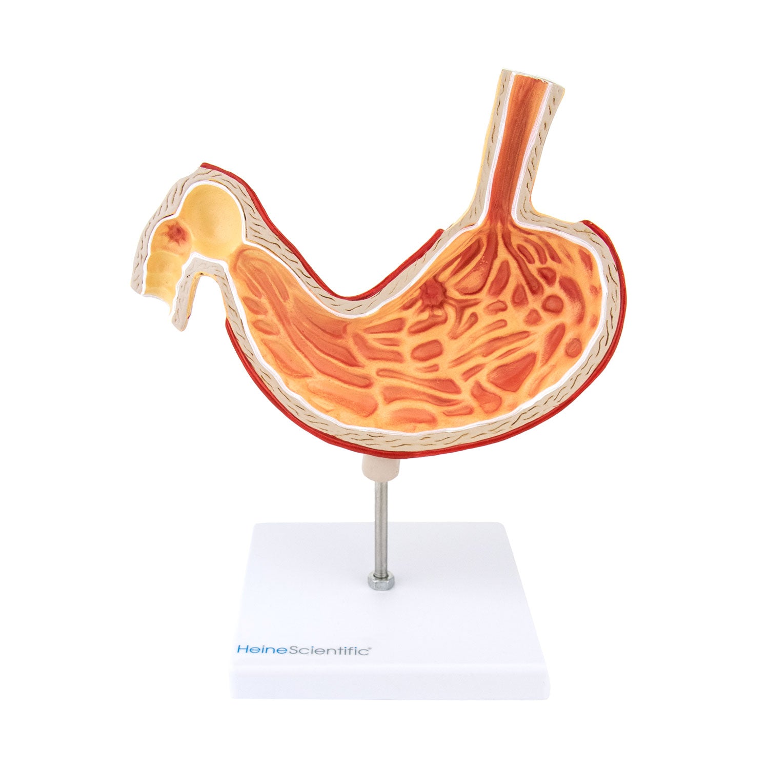 Stomach Model   Shows Stomach Structure   Gastric Mucosa And 2 Ulcers