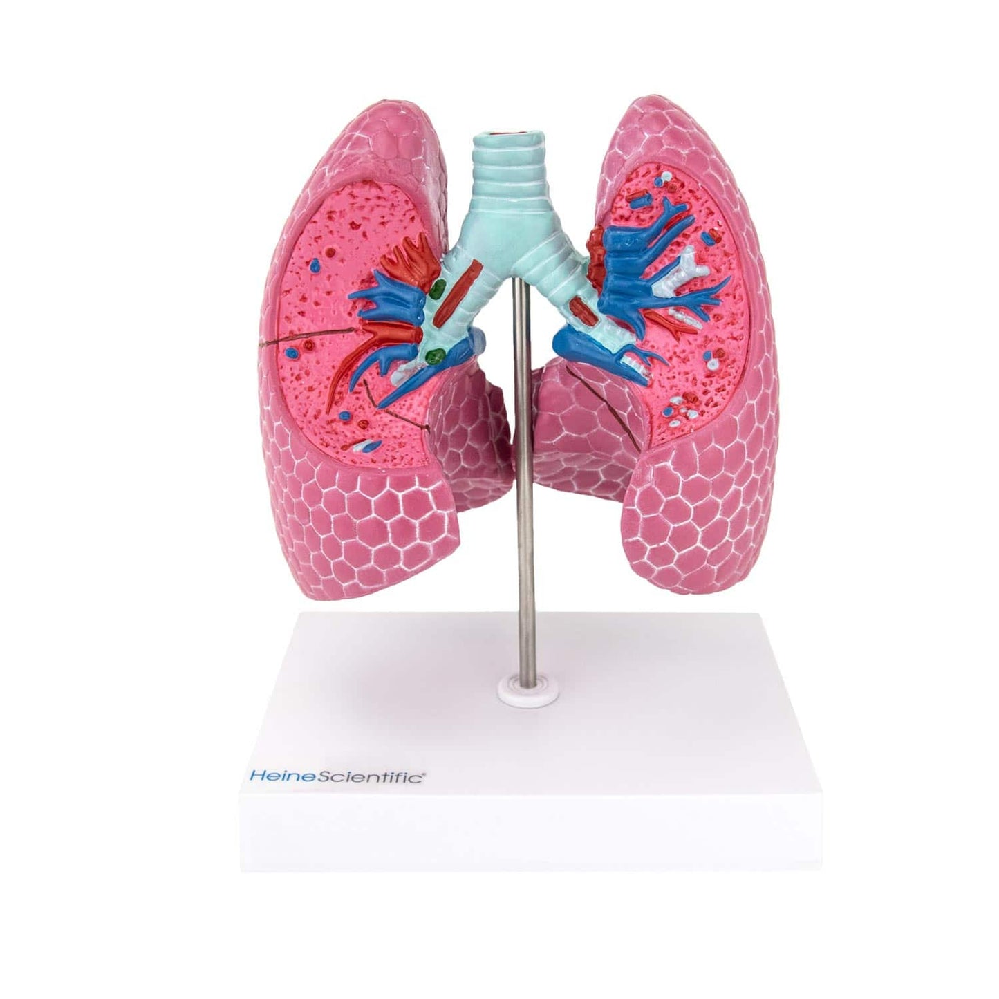 Lung Model With Anatomical Structures And Diseases From Heinescientific
