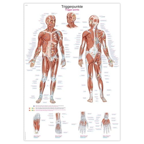 Trigger Points Wall Chart For Patient Education